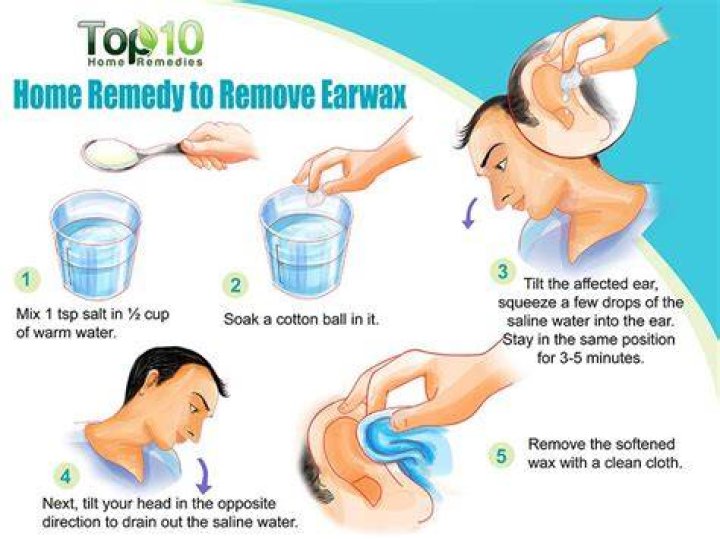 Can warm water get rid of earwax?