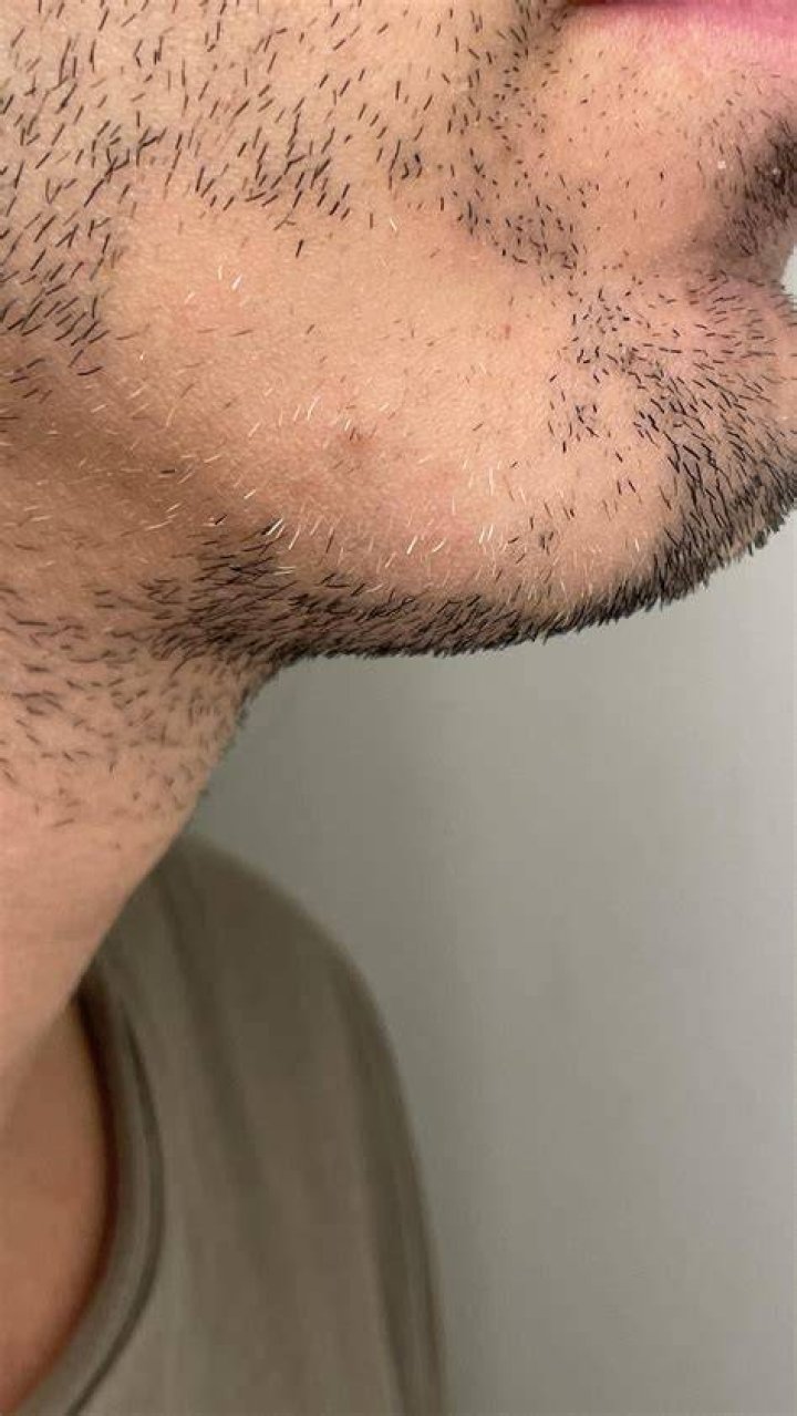 How do guys stay hairless?